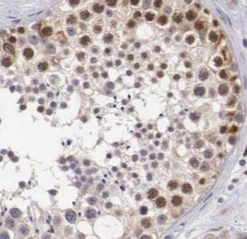 BIRC2 Antibody