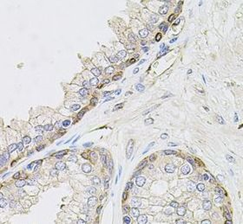 CIB1 Antibody