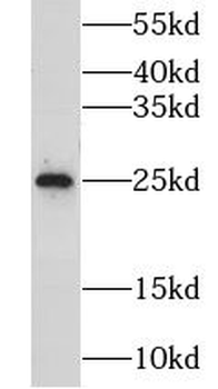 CIDEA Antibody