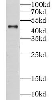 CS Antibody