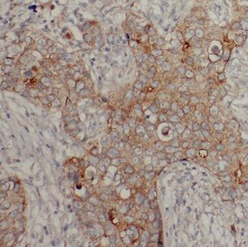 CKMT1A Antibody