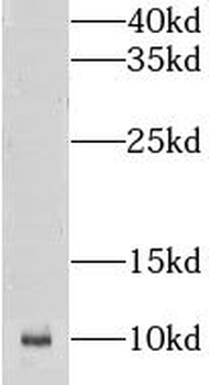 CKS2 Antibody