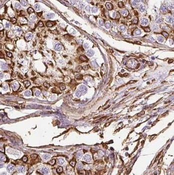 CLDN11 Antibody