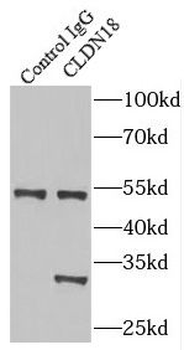CLDN18 Antibody