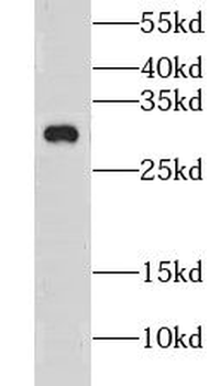 CLEC12B Rabbit Polyclonal Antibody