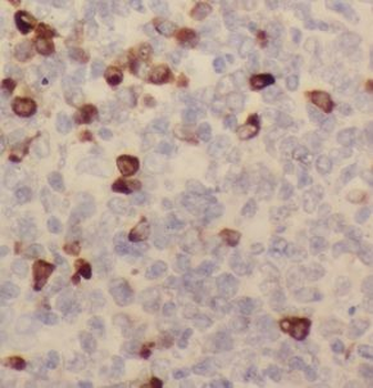 CLEC4M Antibody
