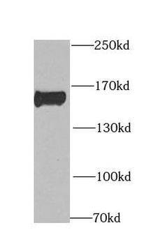 CLIP1 Antibody