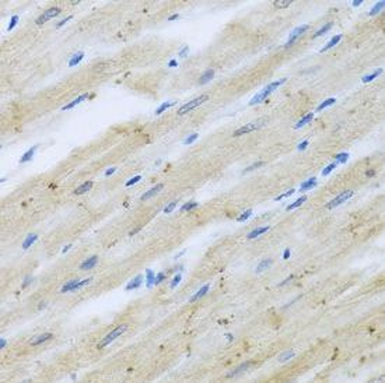 CLIP1 Antibody