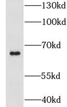 CLIP4 Rabbit Polyclonal Antibody