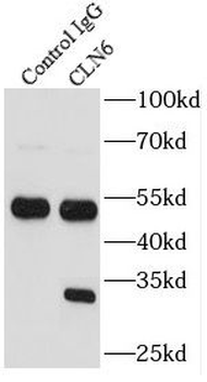CLN6 Antibody