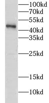 CLP1 Rabbit Polyclonal Antibody