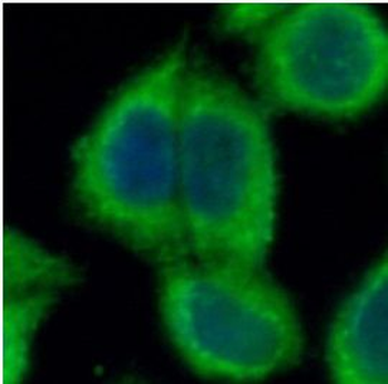 CLPP Antibody