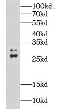 CLPP Antibody