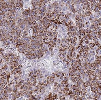 CLPP Antibody