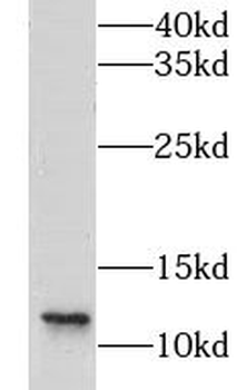CLPS Rabbit Polyclonal Antibody