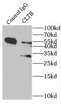 CLTB Antibody