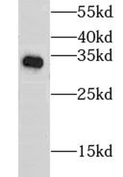 CLTB Antibody
