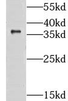 CLYBL Antibody