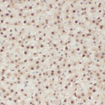 CLYBL Antibody