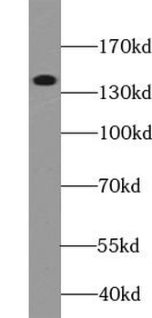 MET Rabbit Polyclonal Antibody