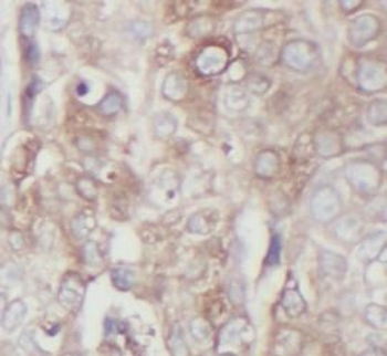 MET Rabbit Polyclonal Antibody