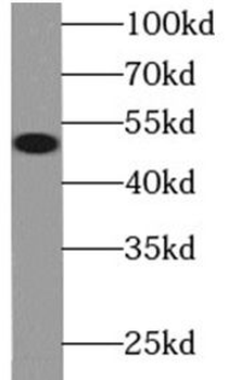 MYC Rabbit Polyclonal Antibody