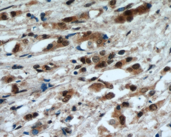 MYC Rabbit Polyclonal Antibody