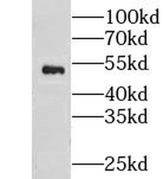 CNDP2 Antibody