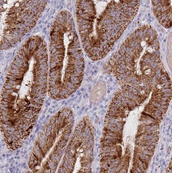 CNOT10 Antibody