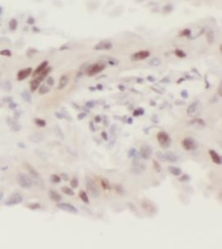 CNOT4 Antibody