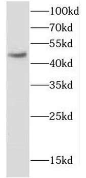CNP Rabbit Polyclonal Antibody