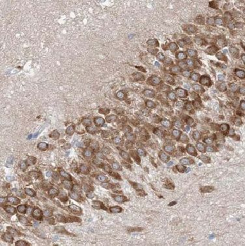 CNP Rabbit Polyclonal Antibody