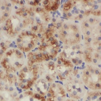 CNRIP1 Antibody