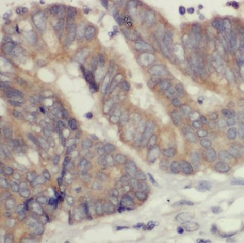 COASY Antibody