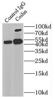 COIL Antibody