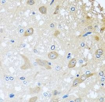COLEC11 Antibody