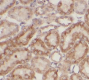 Collagen Type IV Antibody