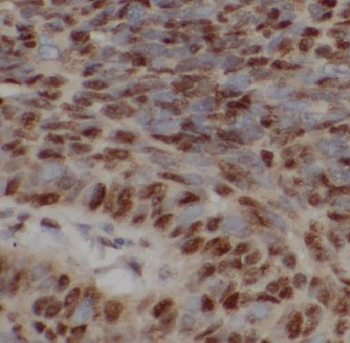 COMMD1 Antibody