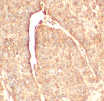 CFH Antibody
