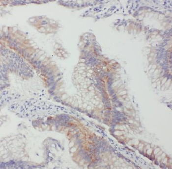 GJB2 Antibody