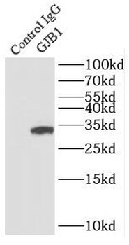GJB1 Antibody
