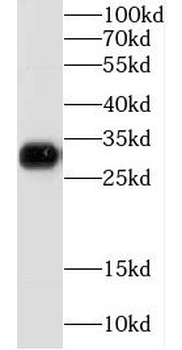 GJB1 Antibody