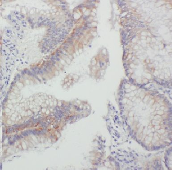 GJB1 Antibody