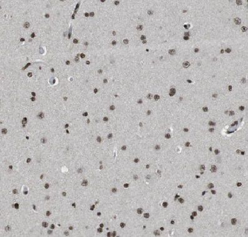 COPS8 Antibody