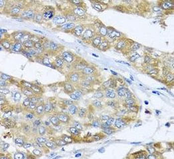 COQ7 Antibody