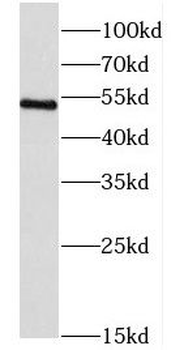 CORO2B Antibody