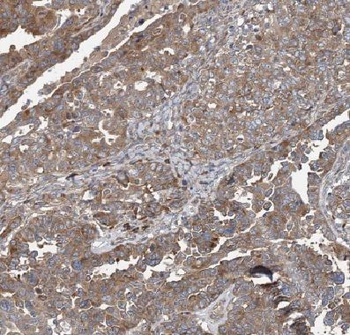 CORO2B Antibody