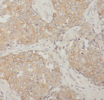 CTTN Antibody