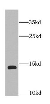 COTL1 Rabbit Polyclonal Antibody