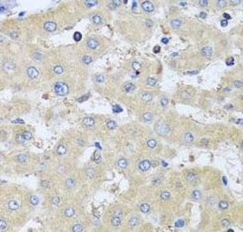COTL1 Rabbit Polyclonal Antibody